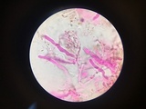 Corticium meridioroseum image