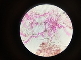 Corticium meridioroseum image