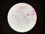 Corticium meridioroseum image