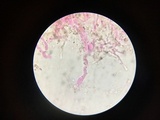 Corticium meridioroseum image