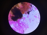 Botryobasidium vagum image