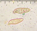Lepiota spheniscispora image
