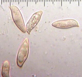 Lepiota spheniscispora image