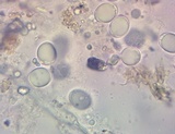Helvella solitaria image
