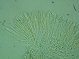Pezizella alniella image