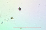 Rinodina californiensis image