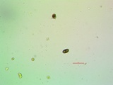 Rinodina californiensis image