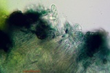 Cercidospora caudata image