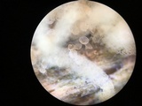 Arcyria obvelata image