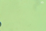 Lyomyces juniperi image