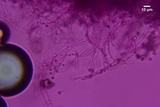 Lyomyces juniperi image
