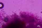 Lyomyces juniperi image