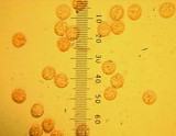 Lycogala epidendrum image