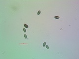 Rinodina californiensis image