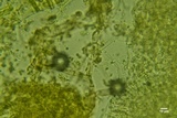 Athelia acrospora image