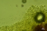 Sistotrema brinkmannii image