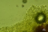 Sistotrema brinkmannii image