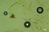 Sistotrema brinkmannii image