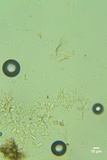 Sistotrema brinkmannii image