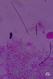 Sistotrema brinkmannii image