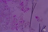 Sistotrema brinkmannii image