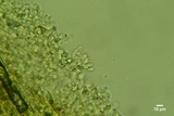 Sistotrema octosporum image