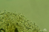 Sistotrema octosporum image