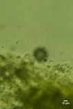 Sistotrema octosporum image