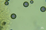 Hyphodontia sambuci image