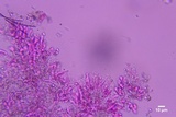 Hyphodontia sambuci image