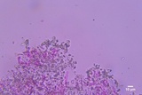 Hyphodontia sambuci image
