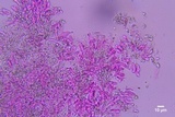 Hyphodontia sambuci image
