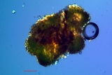Lecanora coniferarum image