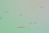 Lecanora coniferarum image