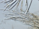 Lachnellula ellisiana image