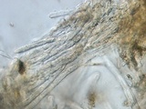 Lachnellula ellisiana image