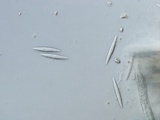 Lachnellula ellisiana image
