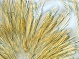 Lachnellula ellisiana image