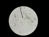 Pseudolaccaria pachyphylla image