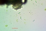 Lecanora simeonensis image