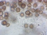 Scleroderma albidum image