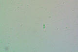 Micarea denigrata image