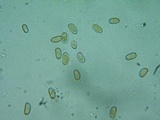 Inocybe rimosa image