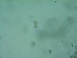 Flammulaster carpophilus var. subincarnatus image