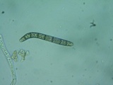 Lasiosphaeria hirsuta image