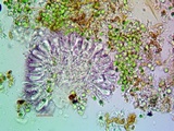 Micarea nitschkeana image