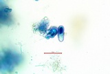 Micarea nitschkeana image