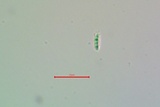 Micarea nitschkeana image