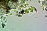 Micarea nitschkeana image