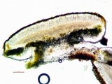 Caloplaca oregona image